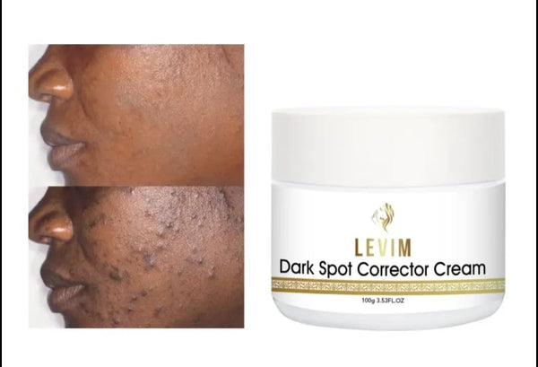 Dark Spots corrector cream